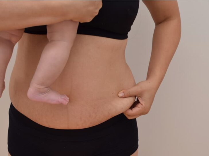 Buik na bevalling & zwangerschap; Tips hoestrakke buik en slappe hangbuik vermijden