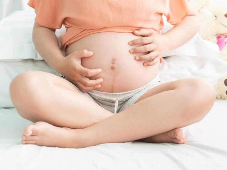 Zwangerschapsjeuk; van jeuk tot bultjes, striemen, droge huid en andere huidklachten