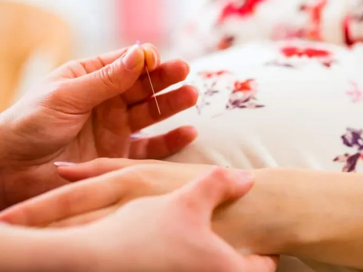Acupunctuur tijdens zwangerschap bij klachten of misselijkheid of weeën opwekken - Mamaliefde.nl