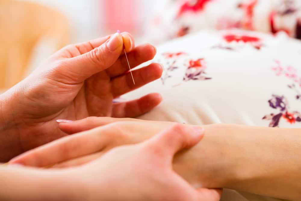 Acupunctuur tijdens zwangerschap zoals bij bevalling opwekken of misselijkheid