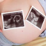 Vermoeden zwanger van een tweeling; symptomen zwangerschap herkennen, bakerpraatjes en verschillen een-eiig en twee-eiig? - Mamaliefde.nl