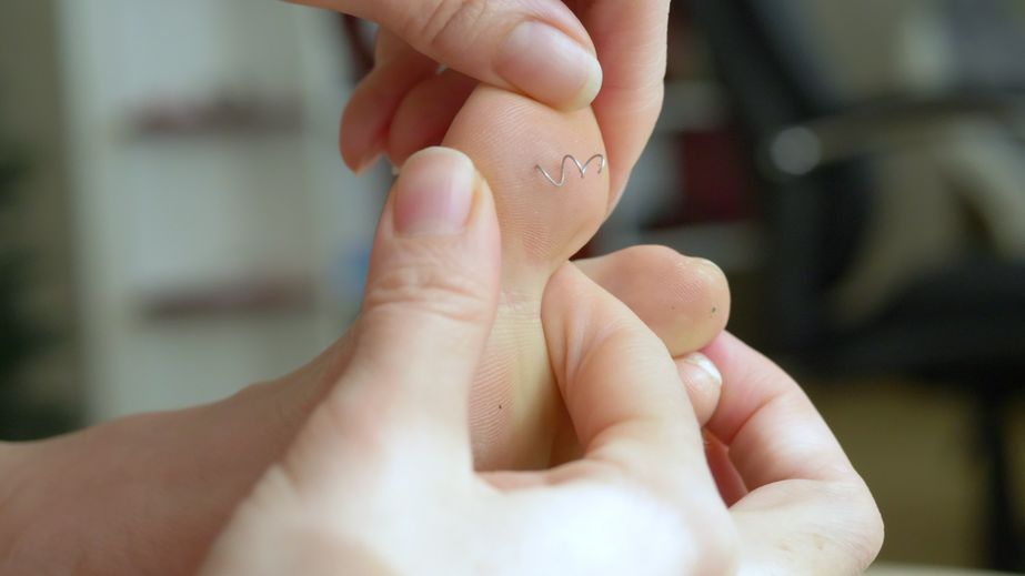 Splinter verwijderen bij kind of baby; ehbo tips en trucs hoe te doen
