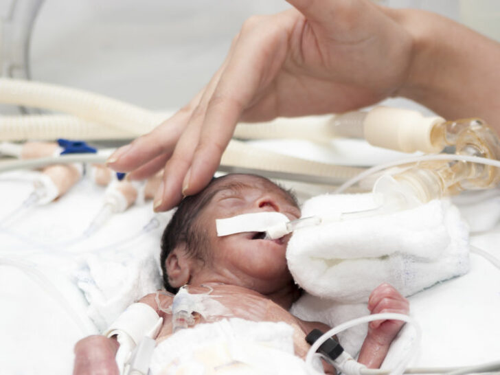 Levensvatbaarheid baby; vanaf wanneer overlevingskans te vroeg geboren baby