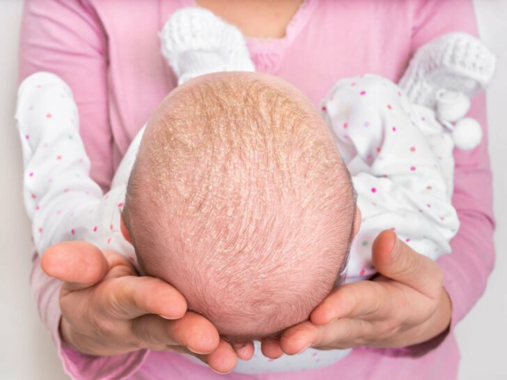 Ontsluiting tijdens de bevalling; symptomen, zelf voelen of meten, en welke fasen eerste 4 of laatste 6 cm wanneer bevallen? - mamaliefde.nl
